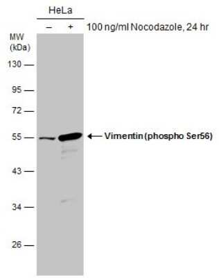 <b>Biological Strategies Validation and Genetic Strategies Validation.</b>Western Blot: Vimentin [p Ser56] Antibody [NBP3-13119] - Untreated (-) and treated (+) HeLa whole cell extracts (30 ug) were separated by 10% SDS-PAGE, and the membrane was blotted with Vimentin (phospho Ser56) antibody (NBP3-13119) diluted at 1:1000.